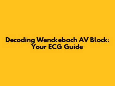 Decoding Wenckebach AV Block: Your ECG Guide