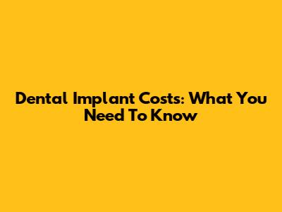 Dental Implant Costs: What You Need To Know