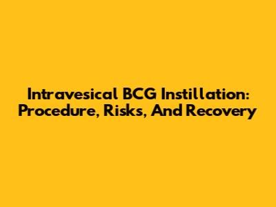 Intravesical BCG Instillation: Procedure, Risks, And Recovery