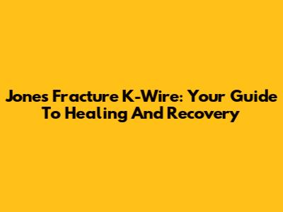 Jones Fracture K-Wire: Your Guide To Healing And Recovery