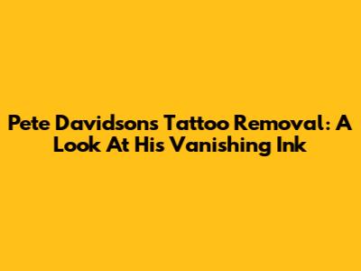 Pete Davidson's Tattoo Removal: A Look At His Vanishing Ink