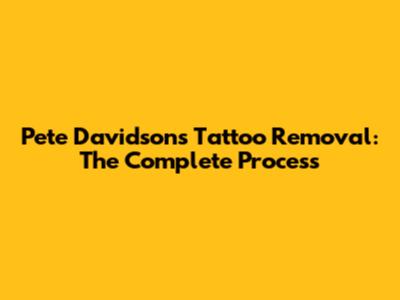 Pete Davidson's Tattoo Removal: The Complete Process