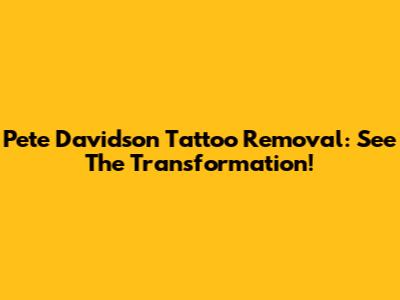 Pete Davidson Tattoo Removal: See The Transformation!